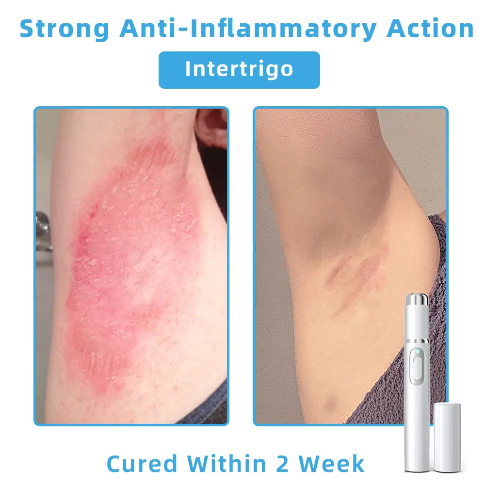 Jilvax™ ClearSkin Pen