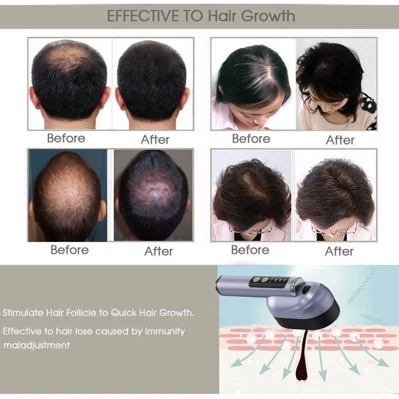 Jilvax™ Hair Growth Electric Massage Comb