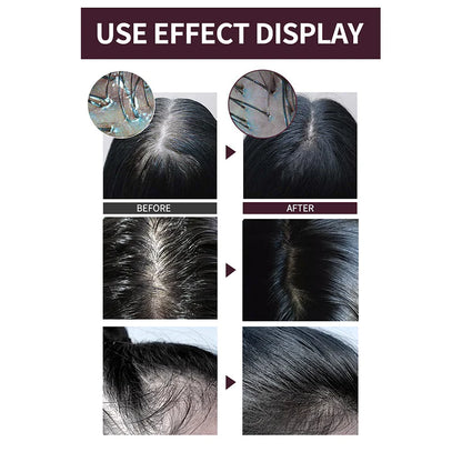 Jilvax™ Hair Growth Electric Massage Comb