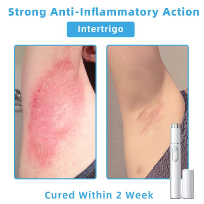 Jilvax™ ClearSkin Pen